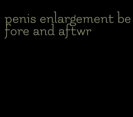penis enlargement before and aftwr